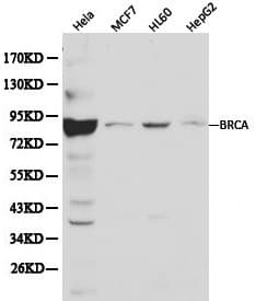Polyclonal Rabbit anti-Human BRCA1 Antibody (WB)