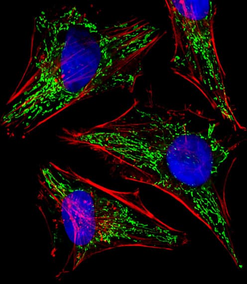 IHC-plus™ Polyclonal Rabbit anti-Human EFTU / TUFM Antibody (aa112-147, IHC, IF, WB)