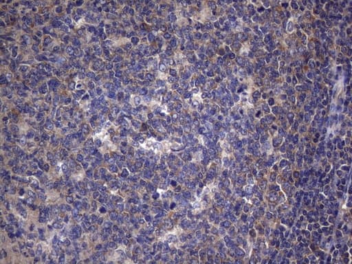 Monoclonal Mouse anti-Human TRIM56 Antibody (clone OTI8E12, aa311-554, IHC, WB)