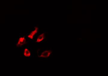 CYP21A2 Antibody