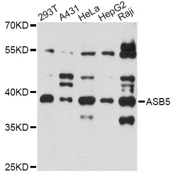 Polyclonal Rabbit anti-Human ASB5 Antibody (WB)