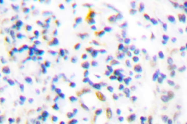 PML Antibody (Pro39)