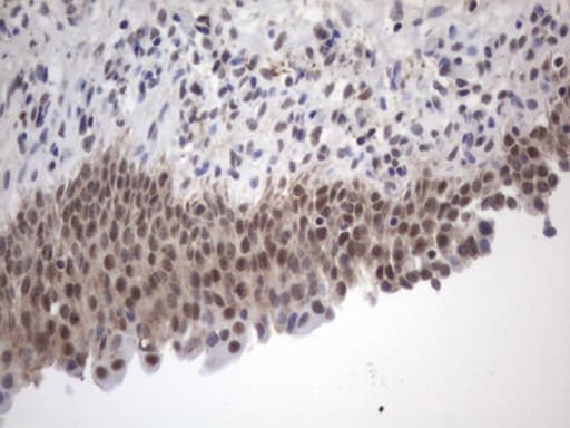 Monoclonal Mouse anti-Human FBXW7 / FBW7 Antibody (clone OTI10B9, aa1-354, IHC, WB)