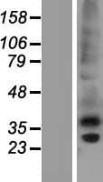 C1QTNF6 / CTRP6 Protein (Over-Expression Lysate Myc-DDK (Flag))