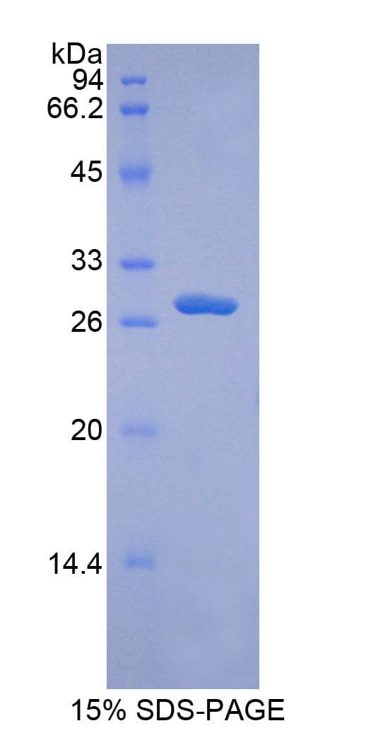Human ADAM9 Protein (Recombinant His)
