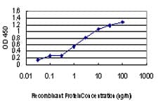 ULK1 Antibody (clone 2H8)
