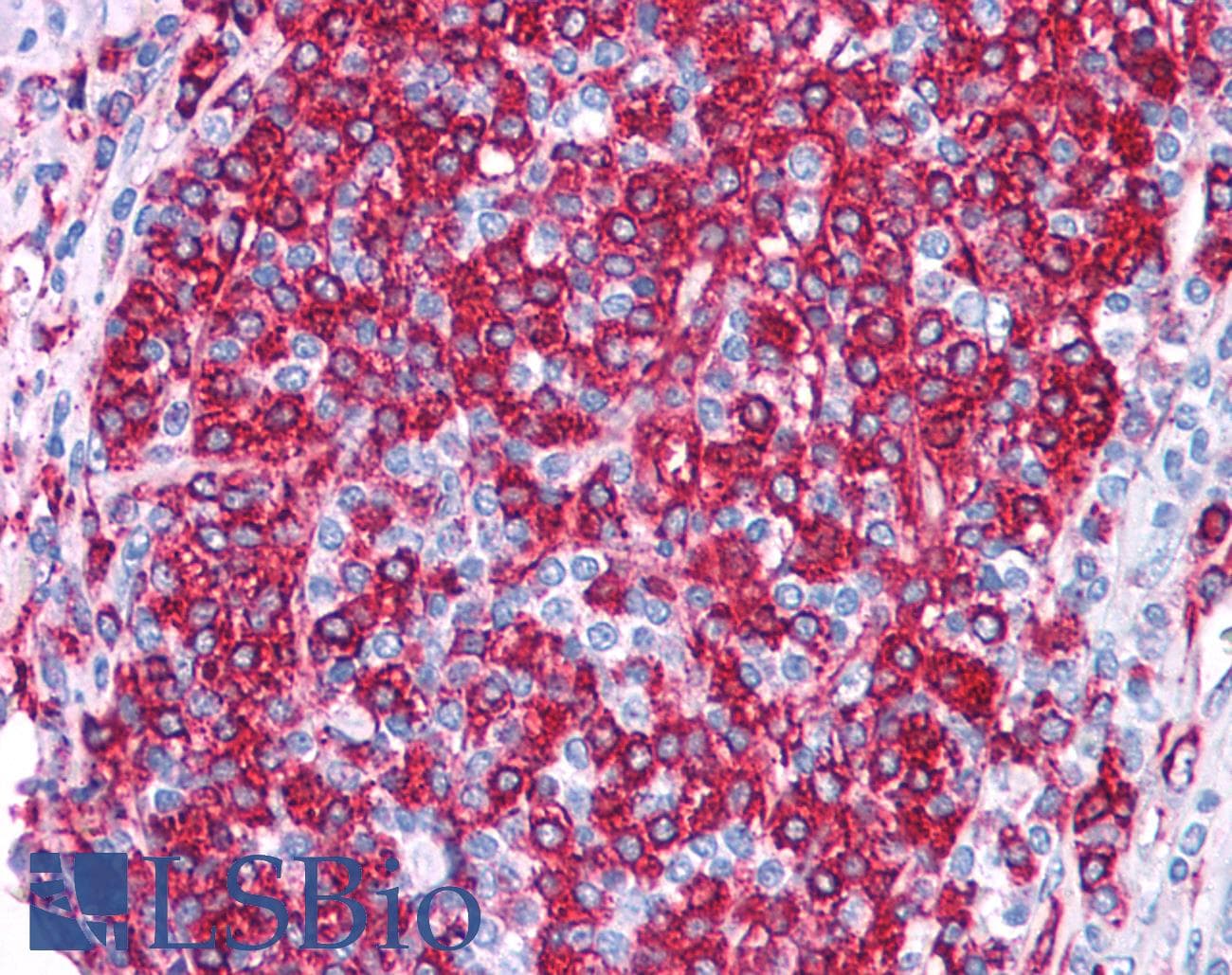 IHC-plus™ Polyclonal Rabbit anti-Human BACE1 / BACE Antibody (N-Terminus, IHC)