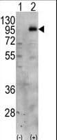 Polyclonal Rabbit anti-Human PIP5K1C Antibody (aa637-668, IHC, WB)