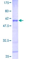 Human HOXB6 Protein (Recombinant GST)