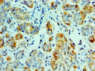 Polyclonal Rabbit anti-Human AMY1A / Salivary Amylase Antibody (aa16-200, IHC)