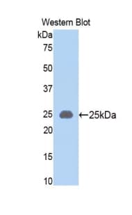SLIT1 Antibody (aa308-512)