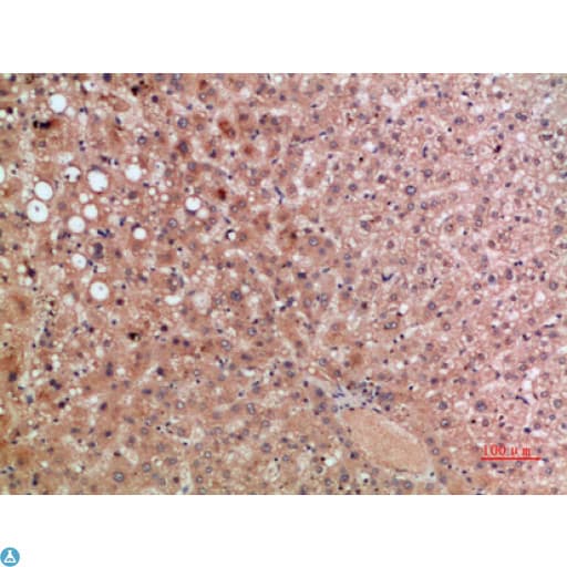CCR5 Antibody