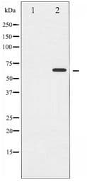 CHEK2 / CHK2 Antibody