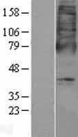 Human OXER1 Protein (Over-Expression Lysate Myc-DDK (Flag))
