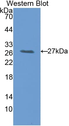 Latexin / MUM Antibody (aa1-222)