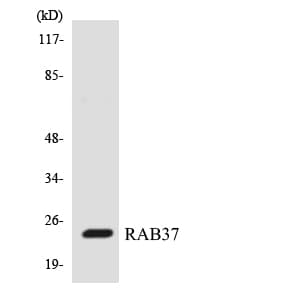 RAB37 Antibody (aa151-200)