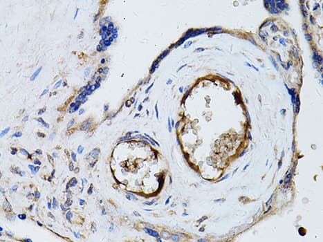 RYR2 / Ryanodine Receptor 2 Antibody