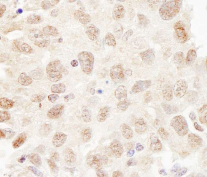 CUL3 / Cullin 3 Antibody (aa650-700)