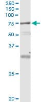 VPS18 Antibody (clone 4E9)