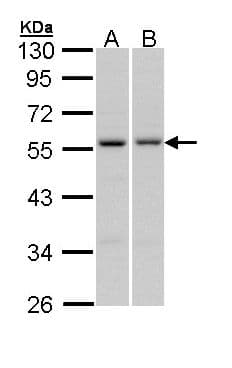 Polyclonal Rabbit anti-Human PAX6 Antibody (IF, WB)