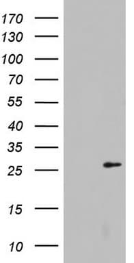 LGALS3 / Galectin 3 Antibody (clone OTI1C7)