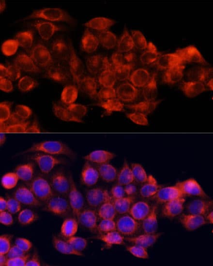 IHC-plus™ APG5 / ATG5 Antibody