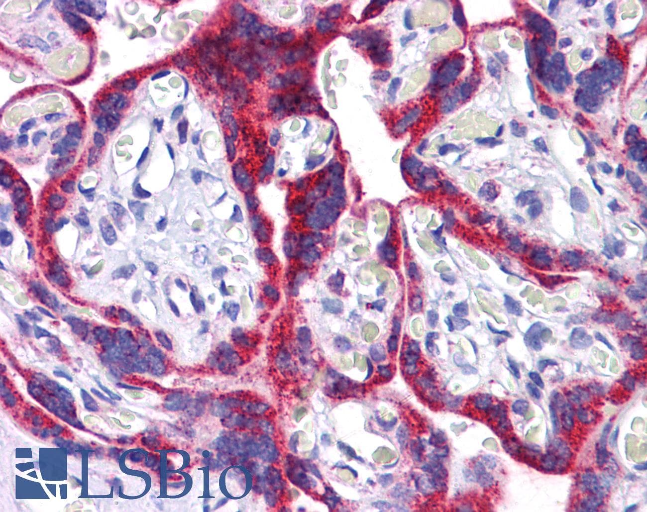 IHC-plus™ Polyclonal Rabbit anti-Human ATG9B Antibody (IHC, IF, WB)
