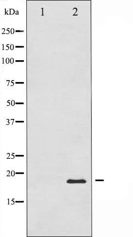 Polyclonal Rabbit anti-Human PIN1 Antibody (IF, WB)