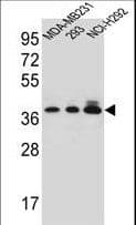 TAS2R1 Antibody (aa267-296)