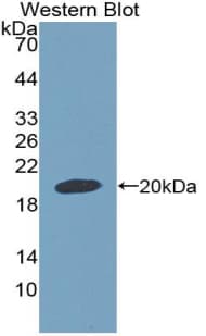 GDF9 / GDF-9 Antibody (aa306-440)