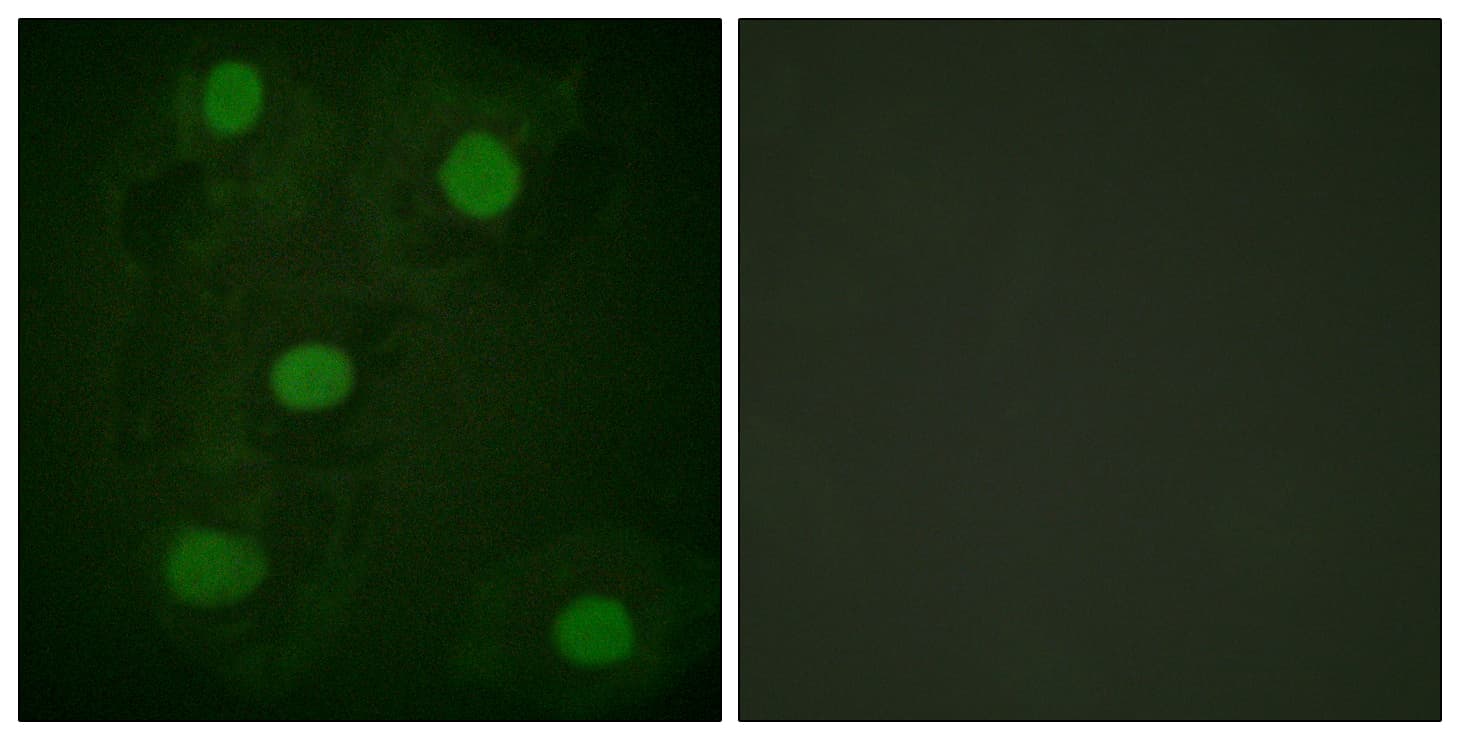 PathPlus™ TP53 / p53 Antibody (aa283-332)