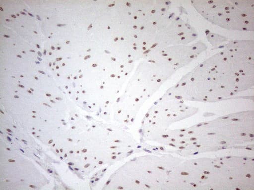 PELI1 / Pellino 1 Antibody (aa1-245, clone OTI13F8)