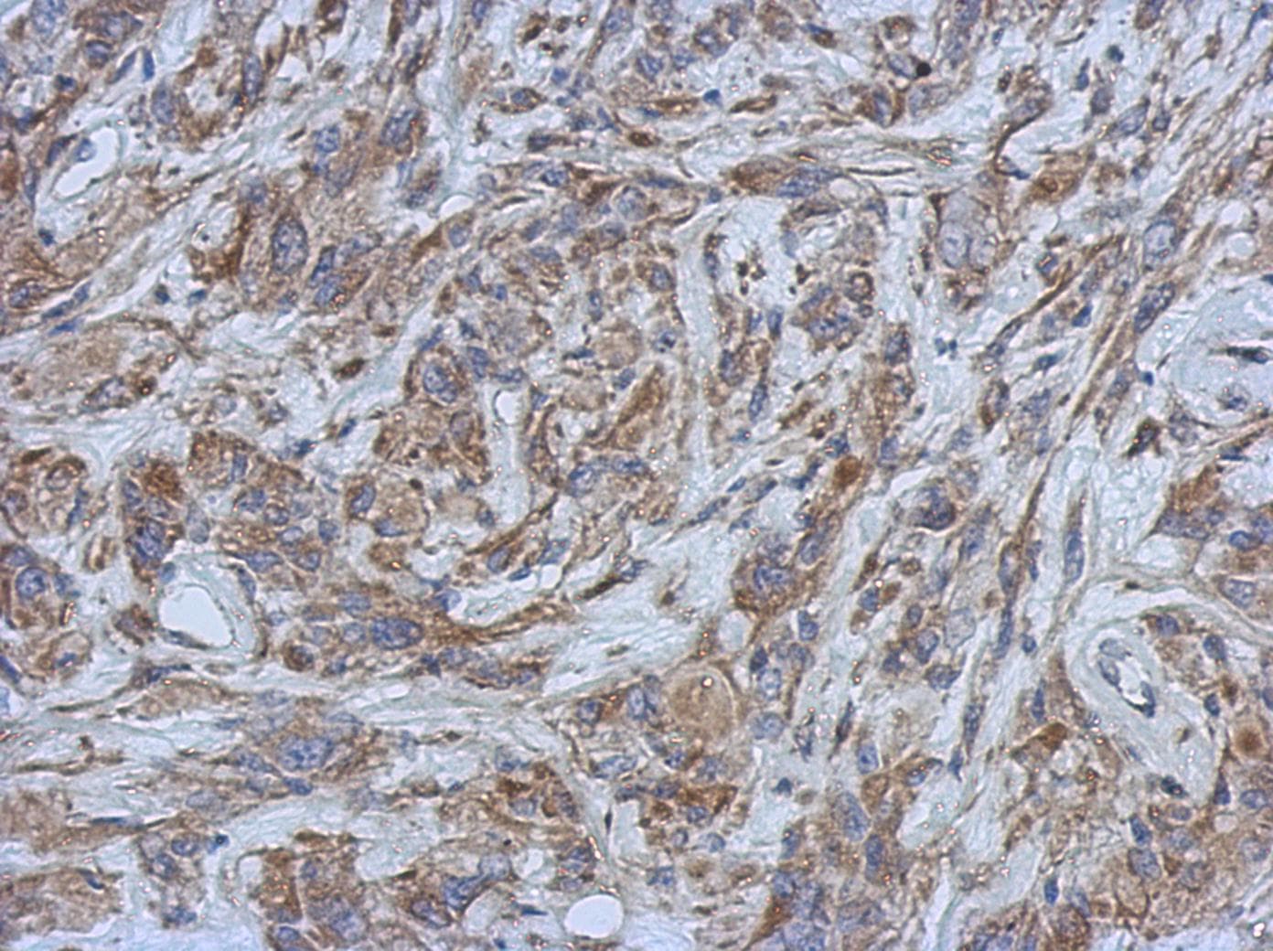 BFSP1 / Filensin Antibody