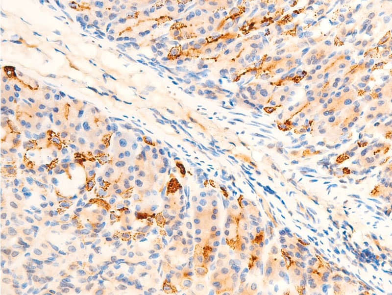 SGK1 / SGK Antibody (phospho-Ser422)