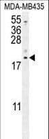 LYRM4 Antibody (aa43-69)