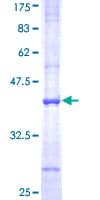 Human SLC3A1 / ATR1 Protein (Recombinant GST, N-terminus)