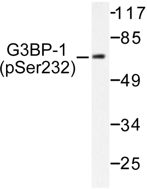 G3BP1 / G3BP Antibody (phospho-Ser232)