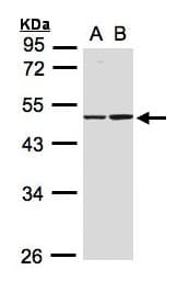 PathPlus™ IDH1 / IDH Antibody