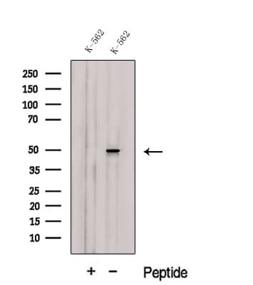 Polyclonal Rabbit anti-Human CELF2 / CUGBP2 Antibody (WB)