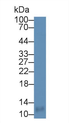 CCL18 / PARC Antibody (aa21-89)