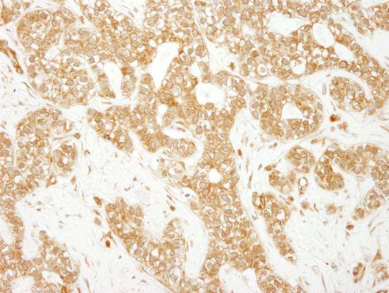EEA1 Antibody (aa100-150)