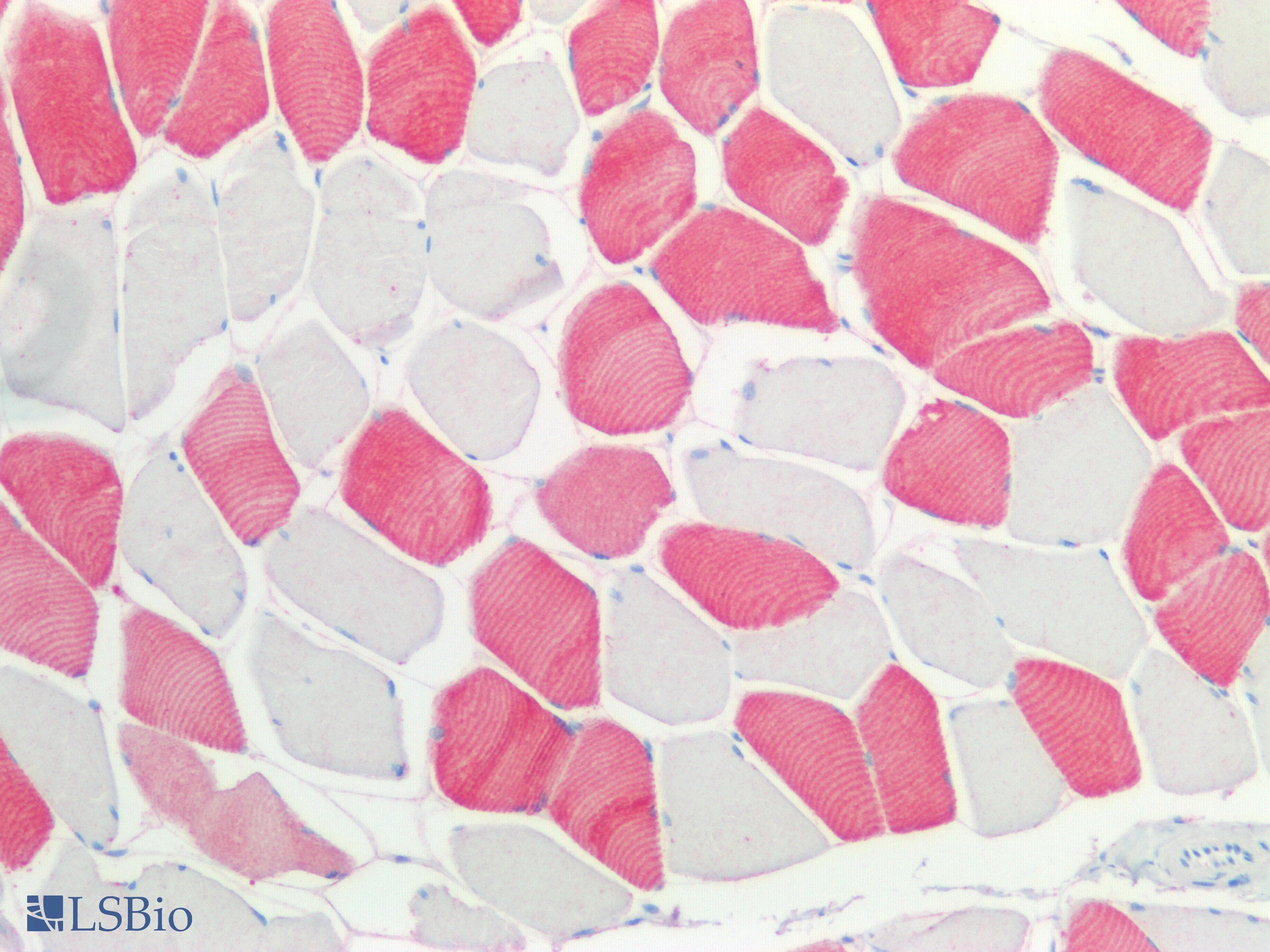 PathPlus™ MYH1 Antibody (aa585-794)