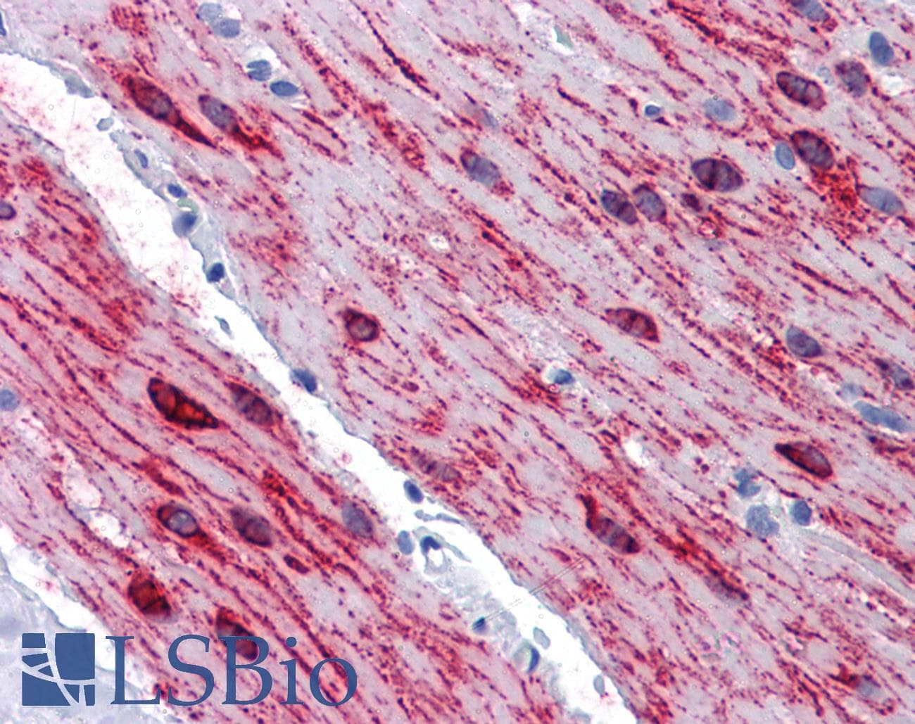 IHC-plus™ SLMAP / SLAP Antibody (clone 2A7)