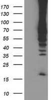 Monoclonal Mouse anti-Human RPN1 / Ribophorin I Antibody (clone OTI1G5, IF, WB)