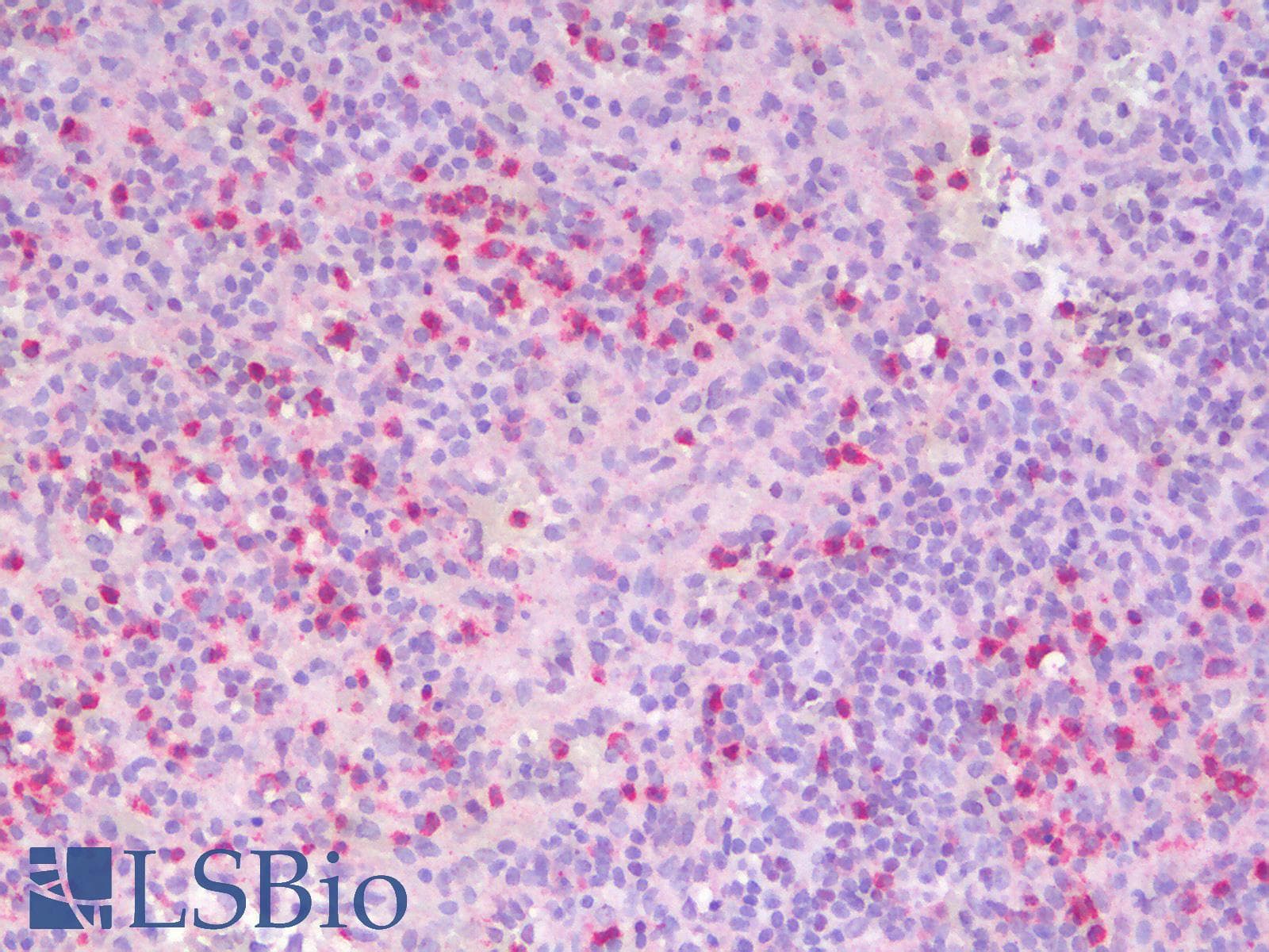 PathPlus™ ITGAX / CD11c Antibody