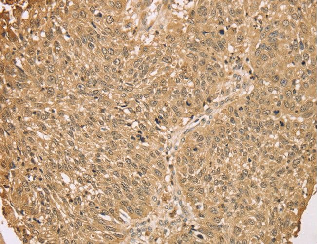 Polyclonal Rabbit anti-Human Calgizzarin / S100A11 Antibody (IHC, WB)