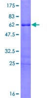 Human HOXD8 Protein (Recombinant GST)