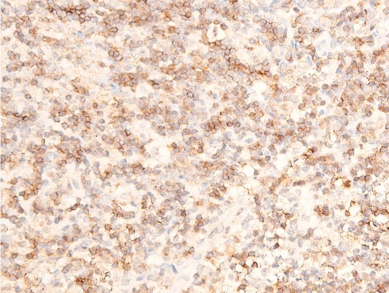 MAP3K7 / TAK1 Antibody (phospho-Thr187)