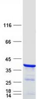 Human NRIP3 Protein (Recombinant Myc-DDK (Flag))