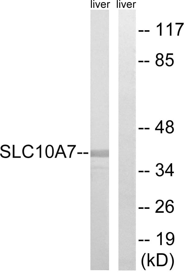 SLC10A7 Antibody (aa168-217)